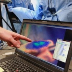 Imagem da notícia: Óculos que detetam células cancerígenas