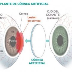 Imagem da notícia: Inova&ccedil;&atilde;o em Oftalmologia a partir da Pen&iacute;nsula Ib&eacute;rica