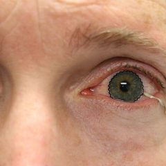 Imagem da notícia: Nova lente de contacto monitoriza doenças oculares