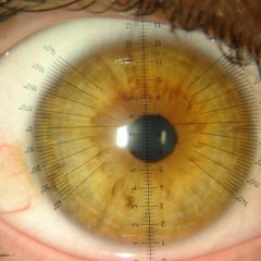 Imagem da notícia: Curso “Contactologia Avançada e Superfície Ocular” com inscrições abertas