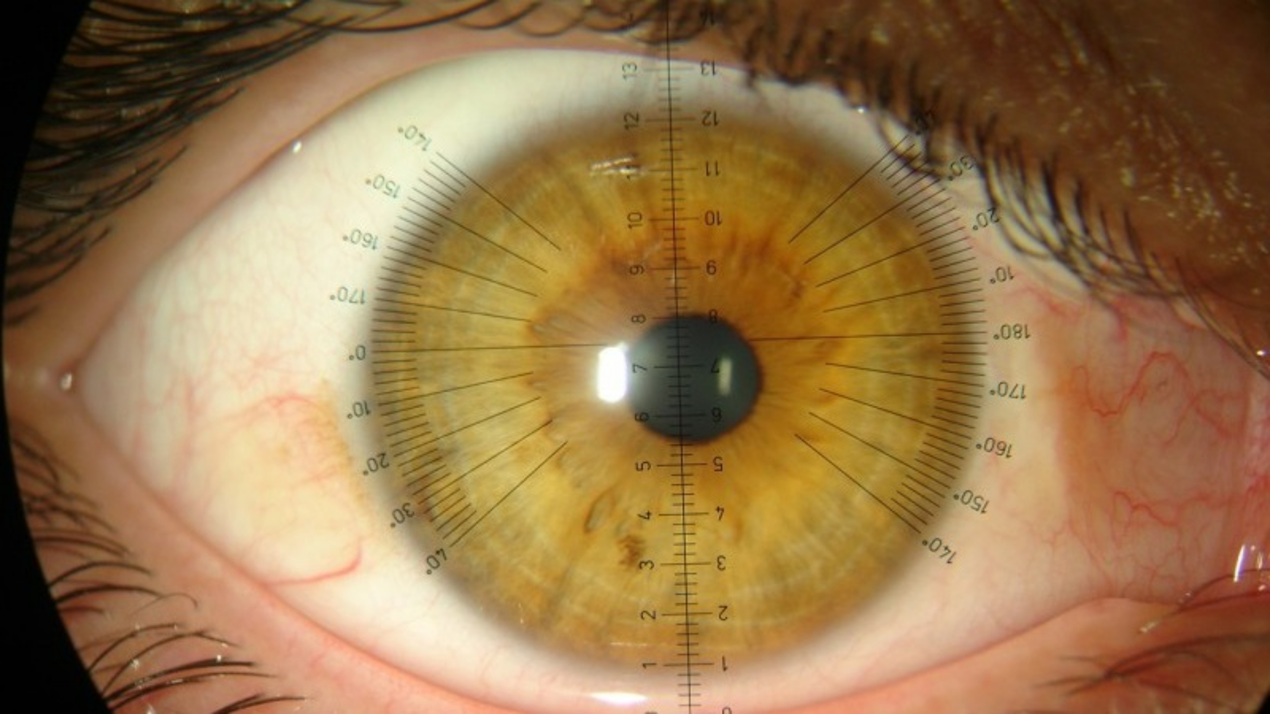 Imagem da notícia: Curso “Contactologia Avançada e Superfície Ocular” com inscrições abertas