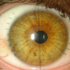 Imagem da notícia: UMinho lança 13ª edição do curso online Contactologia Avançada e Superfície Ocular